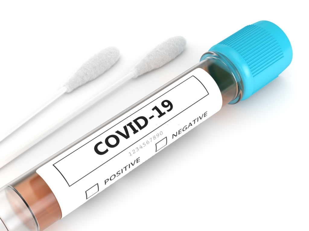 brzi-antigenski-test-na-covid-19