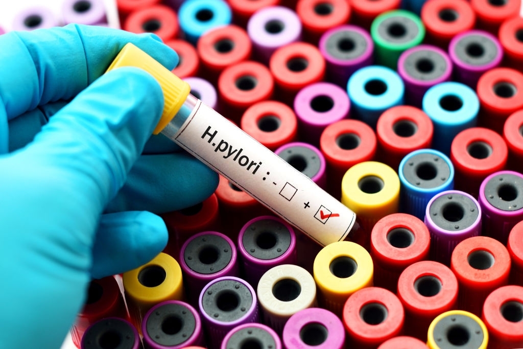 Serološki test na Helicobacter Pylori iz uzorka krvi