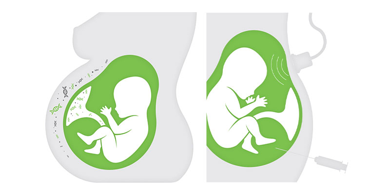 prenatalni-test-ili-amniocenteza
